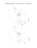Bra Fastener Assembly diagram and image
