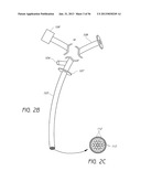 VISUALIZED ENDOTRACHEAL TUBE PLACEMENT SYSTEMS diagram and image