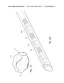 VISUALIZED ENDOTRACHEAL TUBE PLACEMENT SYSTEMS diagram and image