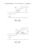 VISUALIZED ENDOTRACHEAL TUBE PLACEMENT SYSTEMS diagram and image