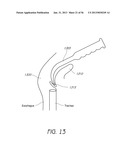 VISUALIZED ENDOTRACHEAL TUBE PLACEMENT SYSTEMS diagram and image