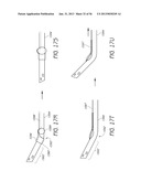 VISUALIZED ENDOTRACHEAL TUBE PLACEMENT SYSTEMS diagram and image