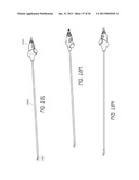 VISUALIZED ENDOTRACHEAL TUBE PLACEMENT SYSTEMS diagram and image