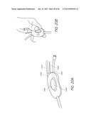 VISUALIZED ENDOTRACHEAL TUBE PLACEMENT SYSTEMS diagram and image