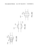 VISUALIZED ENDOTRACHEAL TUBE PLACEMENT SYSTEMS diagram and image