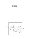 APPARATUS AND METHOD FOR DETECTING LESION AND LESION DIAGNOSIS APPARATUS diagram and image