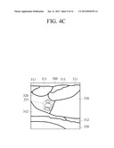 APPARATUS AND METHOD FOR DETECTING LESION AND LESION DIAGNOSIS APPARATUS diagram and image