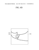 APPARATUS AND METHOD FOR DETECTING LESION AND LESION DIAGNOSIS APPARATUS diagram and image