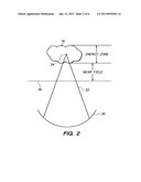 Motion Compensated Image-Guided Focused Ultrasound Therapy System diagram and image