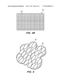 Motion Compensated Image-Guided Focused Ultrasound Therapy System diagram and image