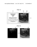 ULTRASONIC OBSERVATION APPARATUS, OPERATION METHOD OF THE SAME, AND     COMPUTER READABLE RECORDING MEDIUM diagram and image