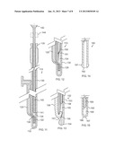 Side-by-side lacrimal intubation threader device diagram and image