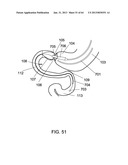 DELIVERY DEVICES AND METHODS FOR GASTROINTESTINAL IMPLANTS diagram and image
