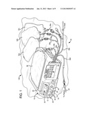 SYSTEM AND METHOD FOR PAIRING A DIALYSIS MACHINE WITH PERIPHERAL DEVICES diagram and image