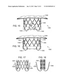 CONICAL CRIMPER diagram and image