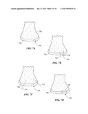 JOINT ARTHROPLASTY DEVICES AND SURGICAL TOOLS diagram and image