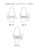 JOINT ARTHROPLASTY DEVICES AND SURGICAL TOOLS diagram and image