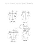 JOINT ARTHROPLASTY DEVICES AND SURGICAL TOOLS diagram and image