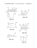 JOINT ARTHROPLASTY DEVICES AND SURGICAL TOOLS diagram and image