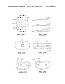 JOINT ARTHROPLASTY DEVICES AND SURGICAL TOOLS diagram and image