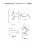 JOINT ARTHROPLASTY DEVICES AND SURGICAL TOOLS diagram and image