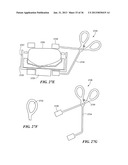 JOINT ARTHROPLASTY DEVICES AND SURGICAL TOOLS diagram and image