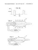 SHOCK WAVE BALLOON CATHETER SYSTEM WITH OFF CENTER SHOCK WAVE GENERATOR diagram and image