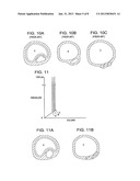 SHOCK WAVE BALLOON CATHETER SYSTEM WITH OFF CENTER SHOCK WAVE GENERATOR diagram and image