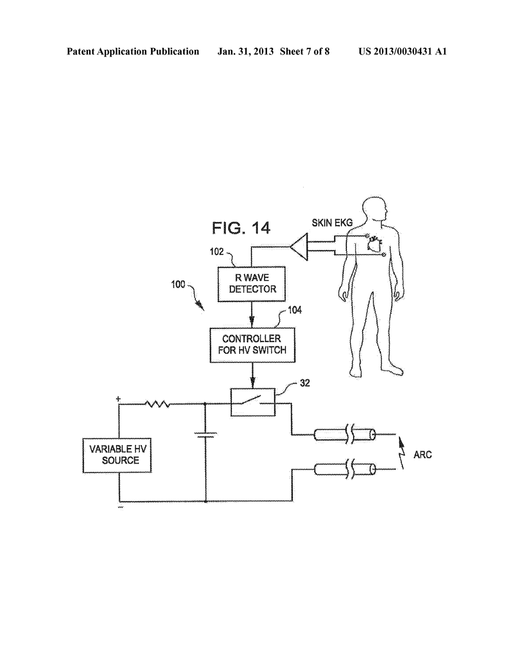 SHOCK WAVE BALLOON CATHETER SYSTEM WITH OFF CENTER SHOCK WAVE GENERATOR - diagram, schematic, and image 08