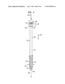 FIXATION SYSTEM, AN INTRAMEDULLARY FIXATION ASSEMBLY AND METHOD OF USE diagram and image