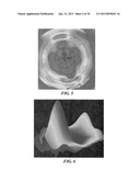 JOINT ARTHROPLASTY DEVICES AND SURGICAL TOOLS diagram and image