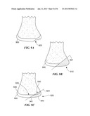 JOINT ARTHROPLASTY DEVICES AND SURGICAL TOOLS diagram and image