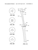 JOINT ARTHROPLASTY DEVICES AND SURGICAL TOOLS diagram and image