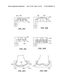 JOINT ARTHROPLASTY DEVICES AND SURGICAL TOOLS diagram and image