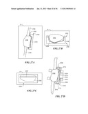 JOINT ARTHROPLASTY DEVICES AND SURGICAL TOOLS diagram and image