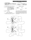 CROSSOVER SPINOUS PROCESS IMPLANT diagram and image