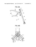 CROSSOVER SPINOUS PROCESS IMPLANT diagram and image