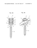 RECEIVING PART FOR CONNECTING A SHANK OF A BONE ANCHORING ELEMENT TO A ROD     AND BONE ANCHORING DEVICE WITH SUCH A RECEIVING PART diagram and image