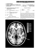 METHOD FOR DEEP BRAIN STIMULATION TARGETING BASED ON BRAIN CONNECTIVITY diagram and image