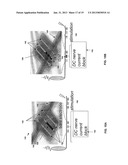 MICROFABRICATED ION-SELECTIVE ELECTRODES FOR FUNCTIONAL ELECTRICAL     STIMULATION AND NEURAL BLOCKING diagram and image