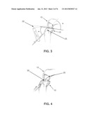 APPARATUS AND METHOD FOR LIGAMENT RECONSTRUCTION diagram and image