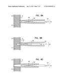 SINUS STENT diagram and image