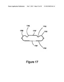 DOSE DELIVERY DEVICE FOR INHALATION diagram and image