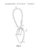 EAS TAG WITH ARTICULATED BODY AND ATTACHING ELEMENT diagram and image