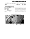 Method and Apparatus for Correction of Errors in Surfaces diagram and image