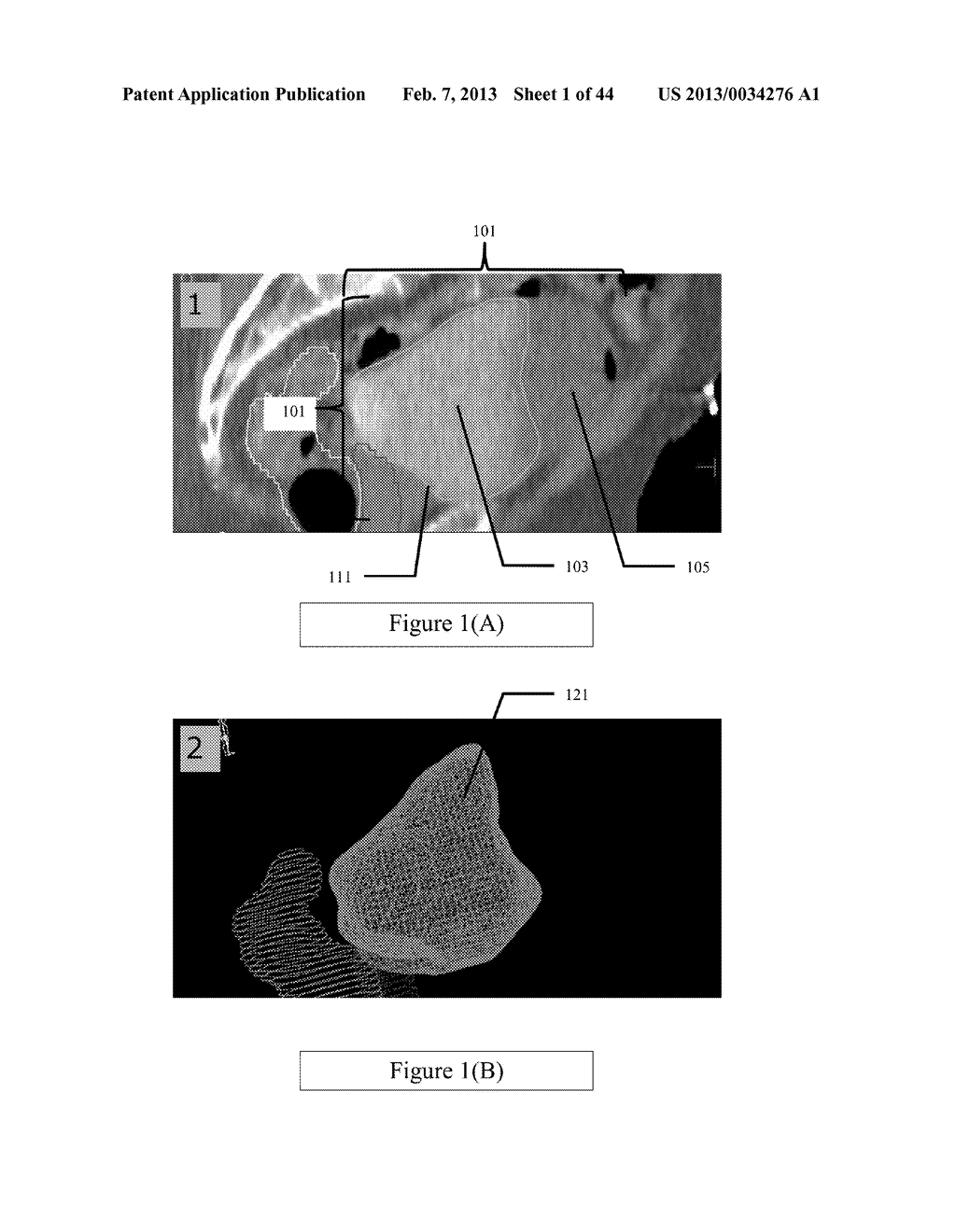 Method and Apparatus for Correction of Errors in Surfaces - diagram, schematic, and image 02