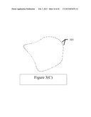 Method and Apparatus for Correction of Errors in Surfaces diagram and image