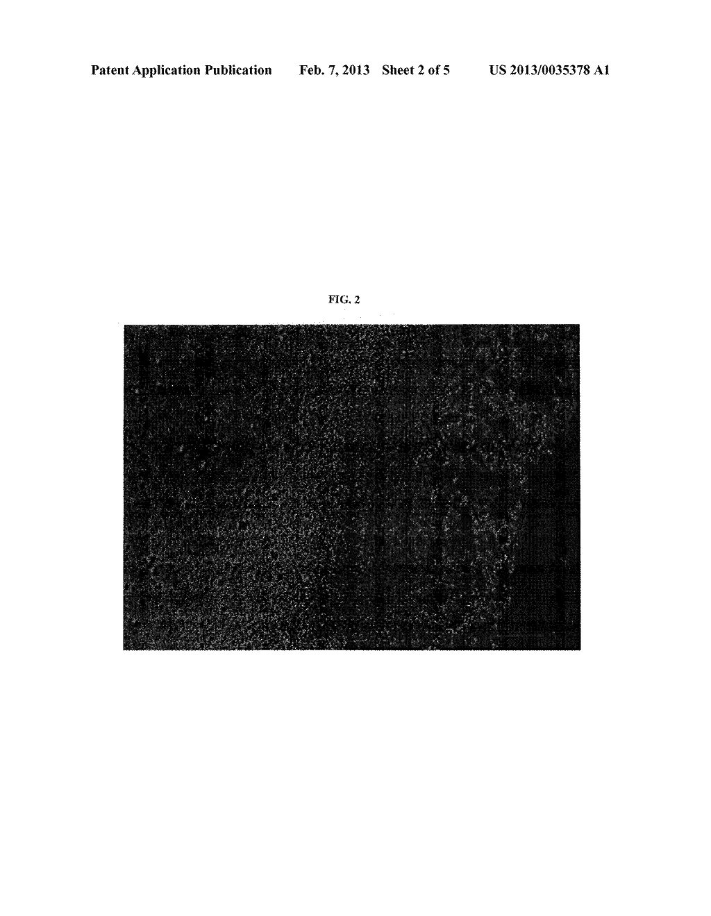 FILM DELIVERY SYSTEM FOR TETRAHYDROLIPSTATIN - diagram, schematic, and image 03