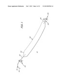 IMPLANTABLE DEVICES, TOOLS AND METHODS FOR ANATOMICAL SUPPORT diagram and image