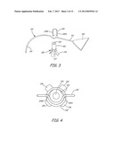 IMPLANTABLE DEVICES, TOOLS AND METHODS FOR ANATOMICAL SUPPORT diagram and image